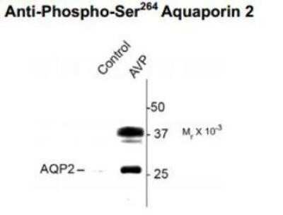 Western Blot: Aquaporin-2 [p Ser264] Antibody [NBP1-48313]